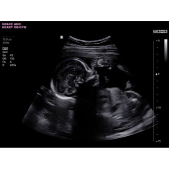 Babylist Registry Photo.