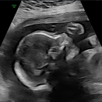 Babylist Registry Photo.