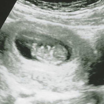 Babylist Registry Photo.
