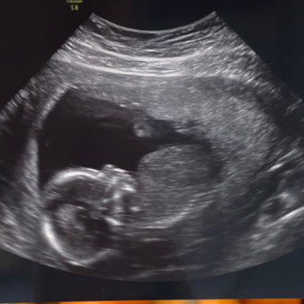 Babylist Registry Photo.