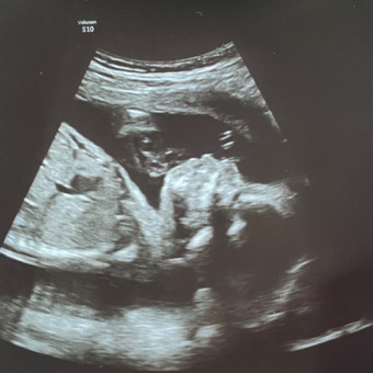 Babylist Registry Photo.