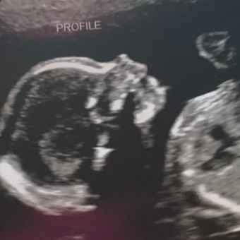 Babylist Registry Photo.