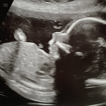 Babylist Registry Photo.
