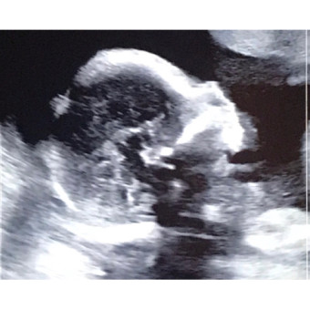 Babylist Registry Photo.