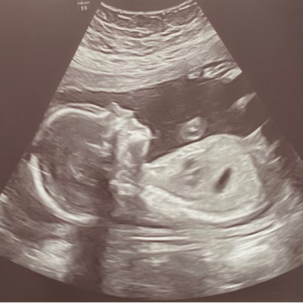 Babylist Registry Photo.
