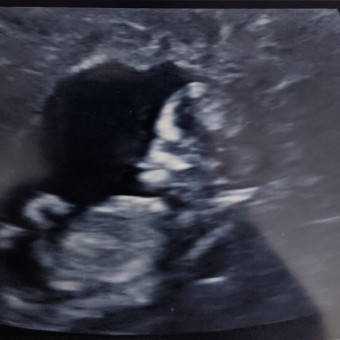 Babylist Registry Photo.