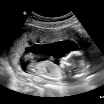 Babylist Registry Photo.