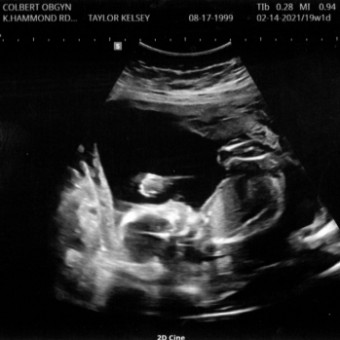 Babylist Registry Photo.