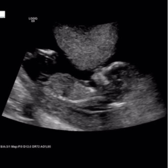 Babylist Registry Photo.