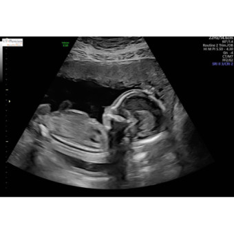 Babylist Registry Photo.