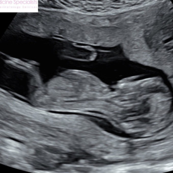 Babylist Registry Photo.