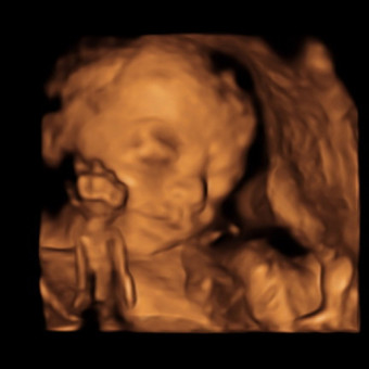 Babylist Registry Photo.