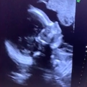 Babylist Registry Photo.