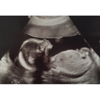 Babylist Registry Photo.