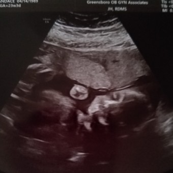 Babylist Registry Photo.
