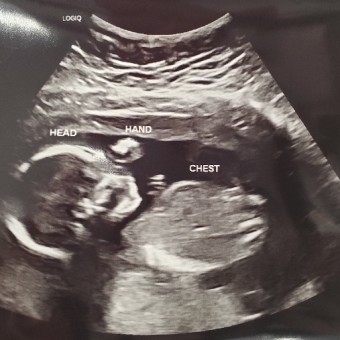 Babylist Registry Photo.