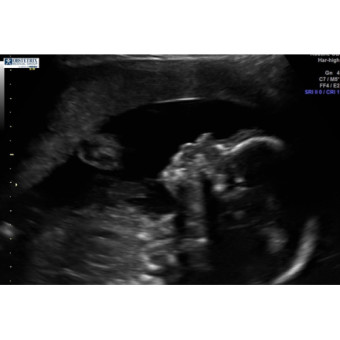 Babylist Registry Photo.