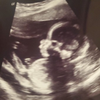Babylist Registry Photo.