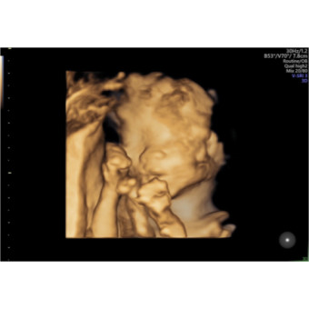 Babylist Registry Photo.