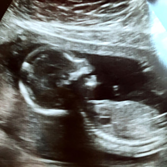 Babylist Registry Photo.