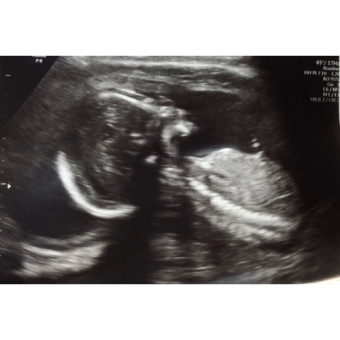 Babylist Registry Photo.