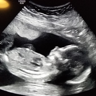 Babylist Registry Photo.