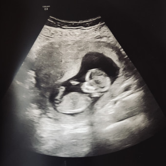Babylist Registry Photo.