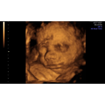 Babylist Registry Photo.