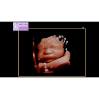 Babylist Registry Photo.