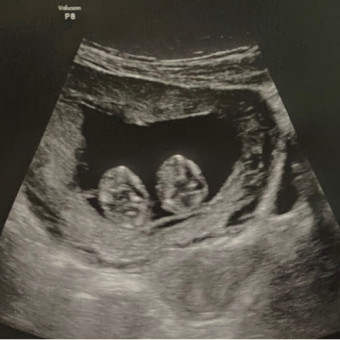 Babylist Registry Photo.