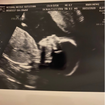 Babylist Registry Photo.