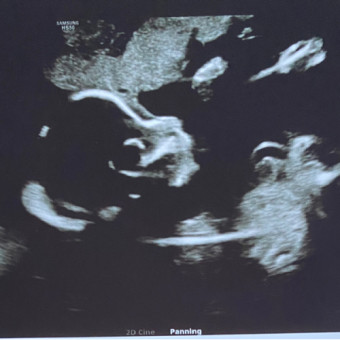 Babylist Registry Photo.