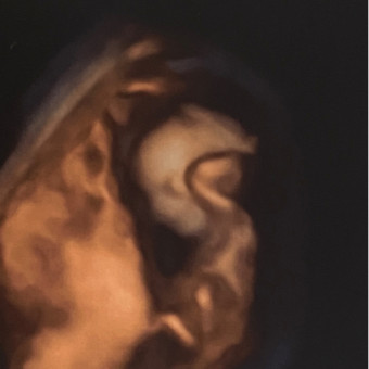 Babylist Registry Photo.