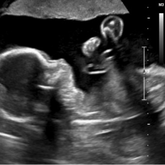 Babylist Registry Photo.
