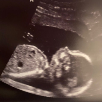 Babylist Registry Photo.