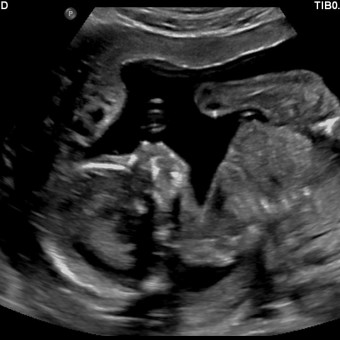 Babylist Registry Photo.