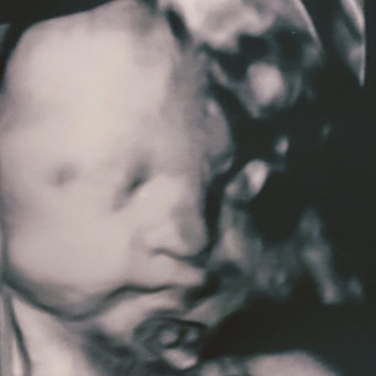 Babylist Registry Photo.