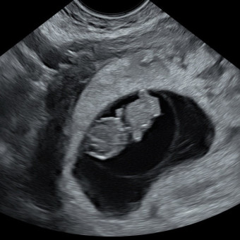 Babylist Registry Photo.