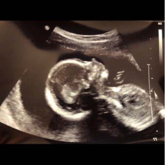 Babylist Registry Photo.