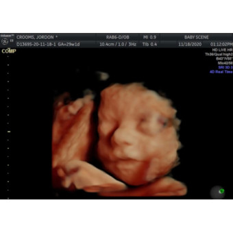 Babylist Registry Photo.