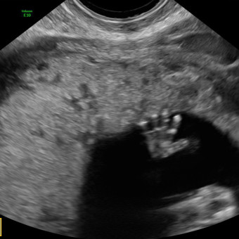 Babylist Registry Photo.