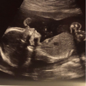 Babylist Registry Photo.