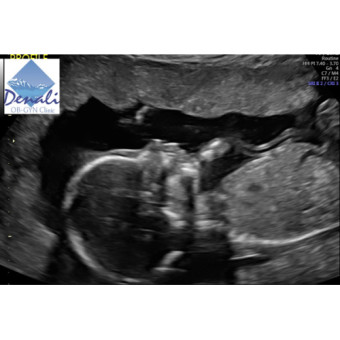 Babylist Registry Photo.