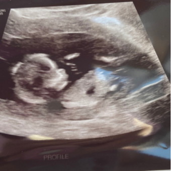 Babylist Registry Photo.