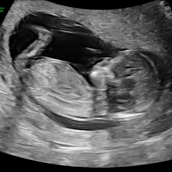 Babylist Registry Photo.