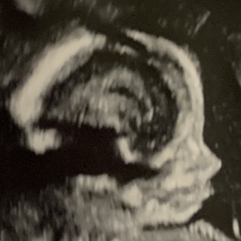 Babylist Registry Photo.