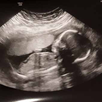 Babylist Registry Photo.