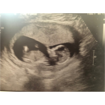 Babylist Registry Photo.