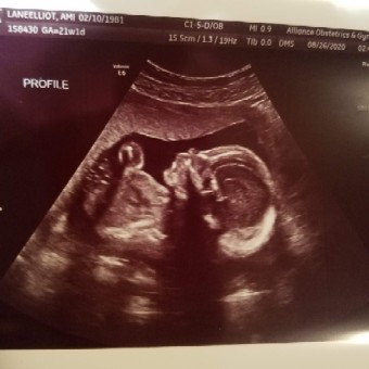 Babylist Registry Photo.
