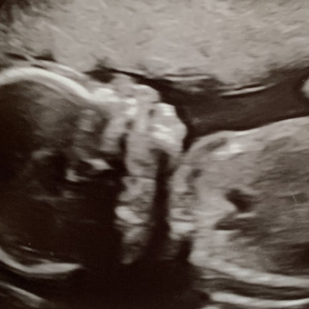 Babylist Registry Photo.